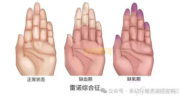 硬甲皮是什么？这几个原因你一定要知道！