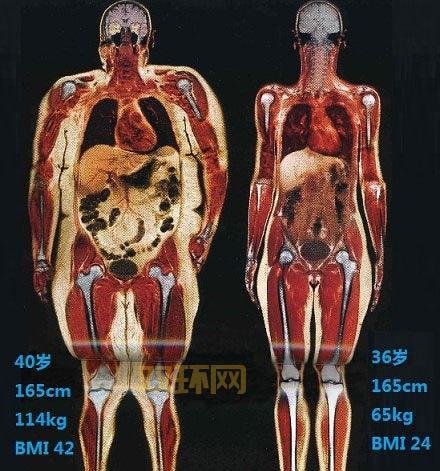 胖子走钢丝能减肥吗？专家告诉你真相！